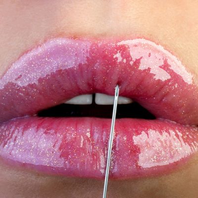 You Could Try BOTOX® on Your Lips But It Could Get Awkward