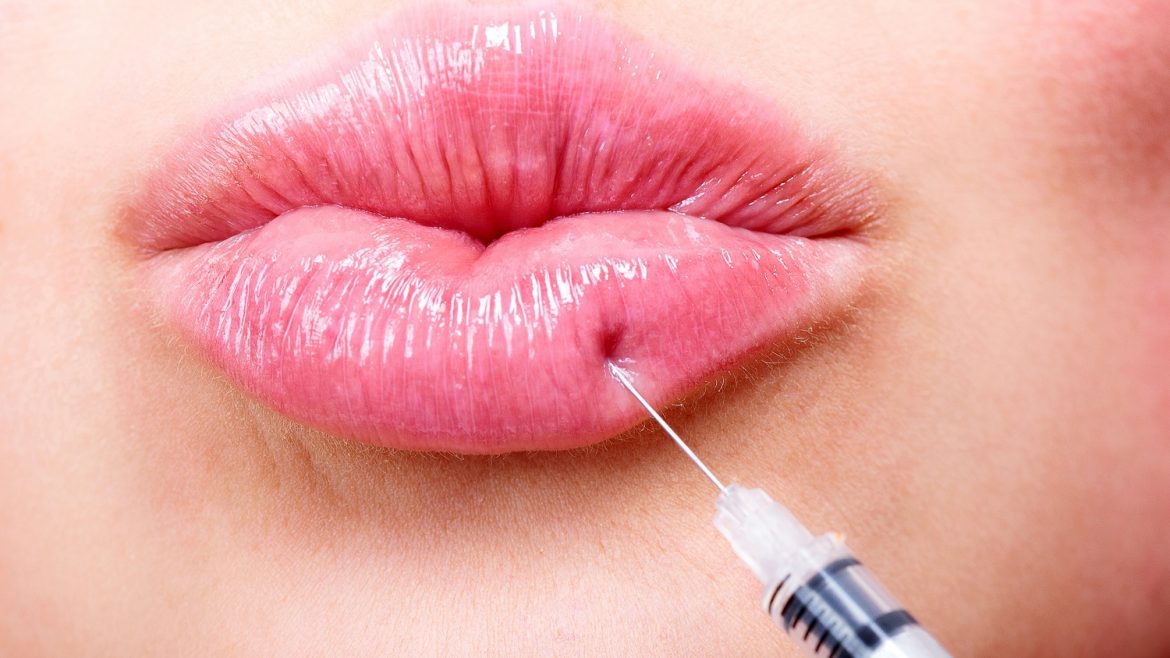 injectables cupid's bow