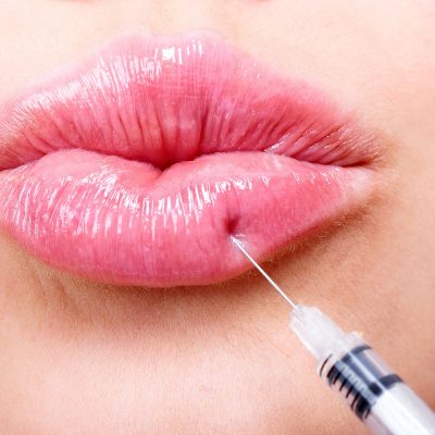 How Injectables Can Put Cupid’s Bow in Your Lip