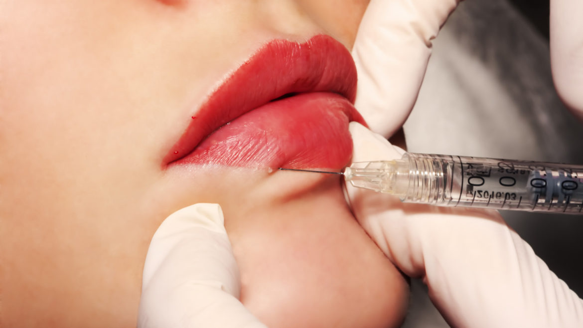 A close up of a woman's lips being injected with filler.